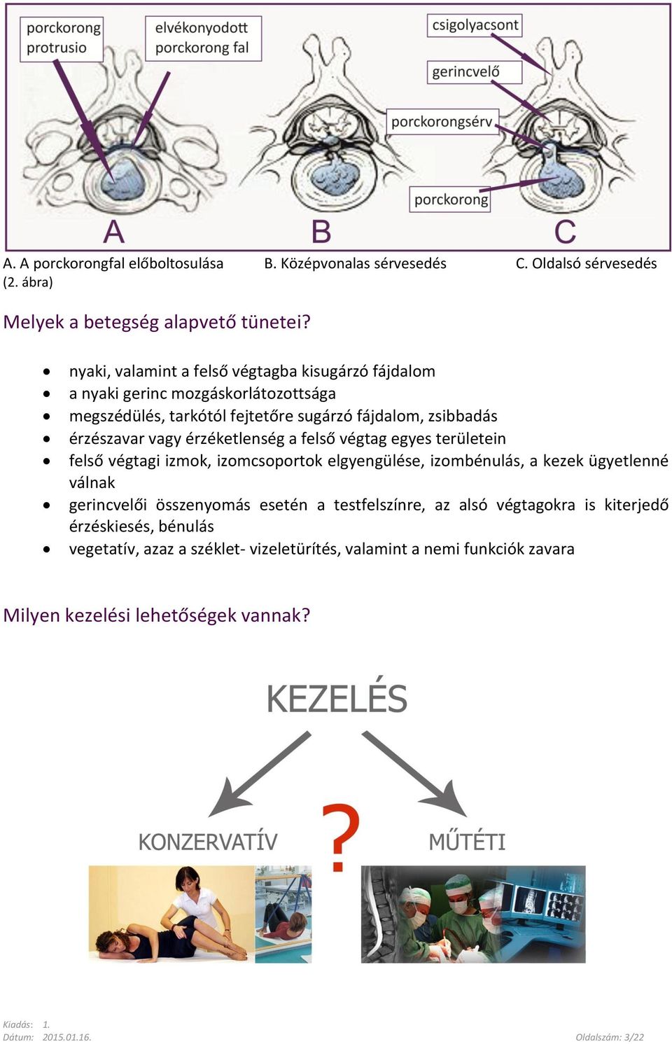 érzéketlenség a felső végtag egyes területein felső végtagi izmok, izomcsoportok elgyengülése, izombénulás, a kezek ügyetlenné válnak gerincvelői összenyomás esetén a