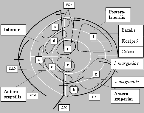 11. ábra A bal kamrai polar map (360 -os térkép) képe mutatja azon régiókat (a-i), ahol az elektromos potenciálvesztés diagnosztizálható a testfelszín isopotenciál térképeken.