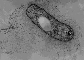 Gram negatív baktériumok G (-) aerob pálcák és kokkuszok Pseudomonasok