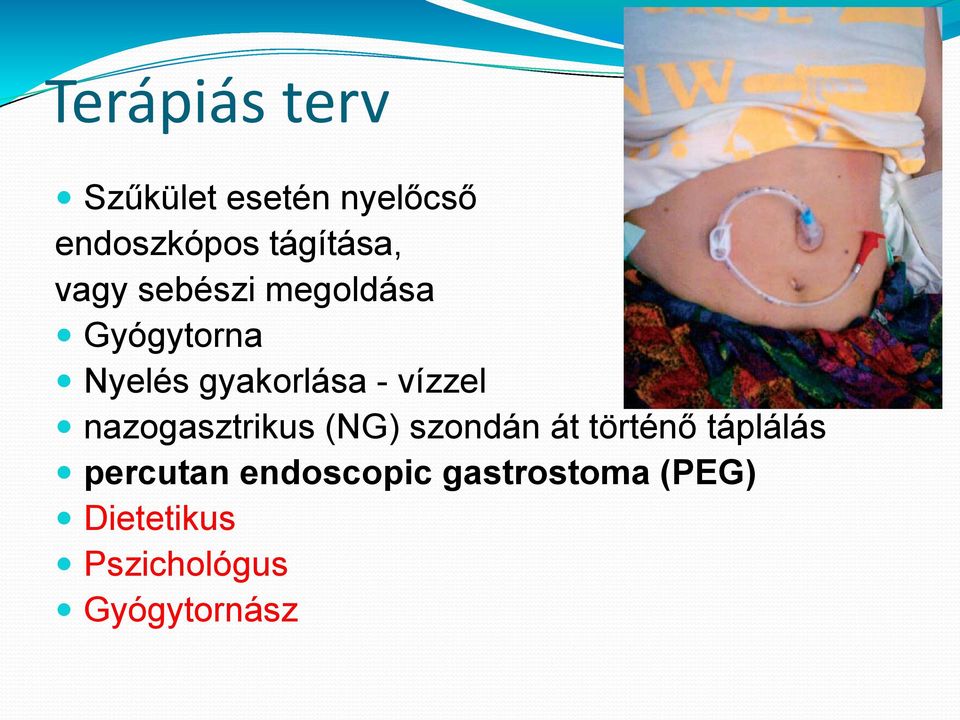 nazogasztrikus (NG) szondán át történő táplálás percutan