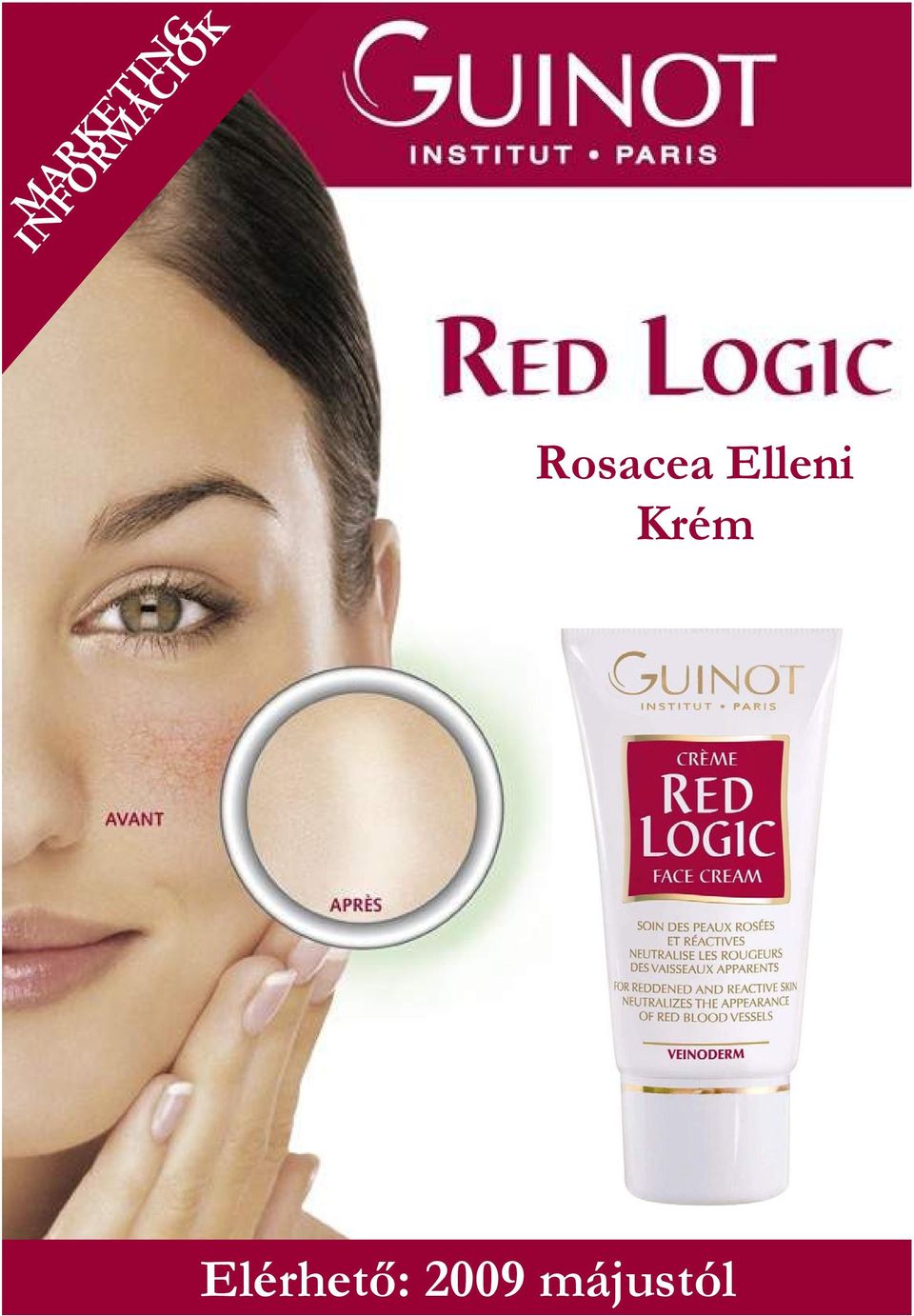 Rosacea Elleni Krém