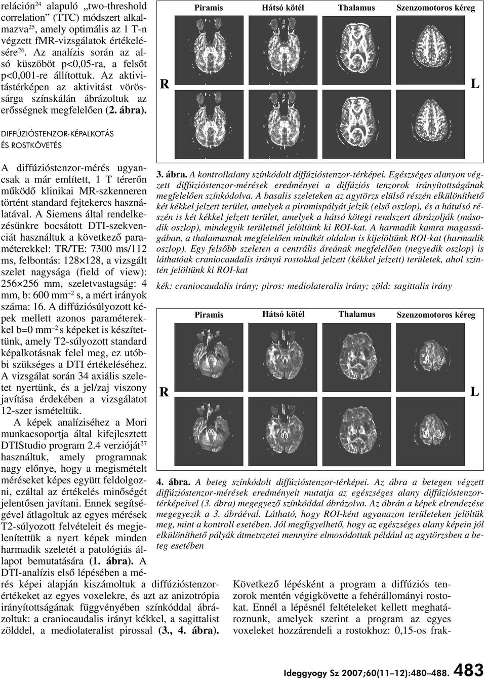 R Piramis Hátsó kötél Thalamus Szenzomotoros kéreg L DIFFÚZIÓSTENZOR-KÉPALKOTÁS ÉS ROSTKÖVETÉS A diffúzióstenzor-mérés ugyancsak a már említett, 1 T térerôn mûködô klinikai MR-szkenneren történt
