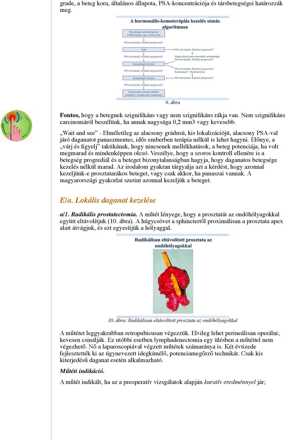 Wait and see - Elméletileg az alacsony grádusú, kis lokalizációjú, alacsony PSA-val járó daganatot panaszmentes, idős emberben terápia nélkül is lehet hagyni.