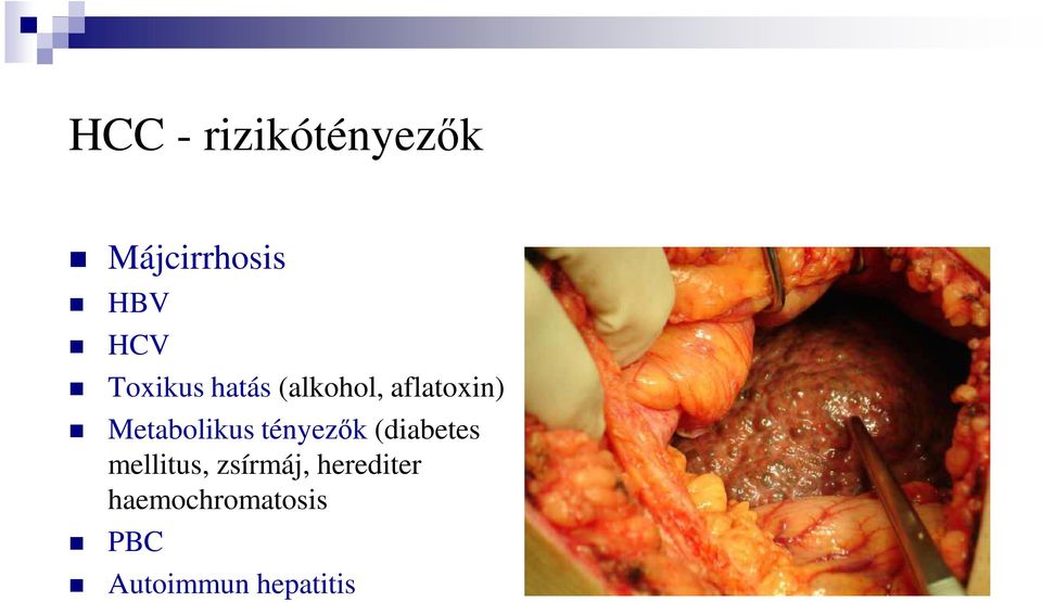 Metabolikus tényezők (diabetes mellitus,