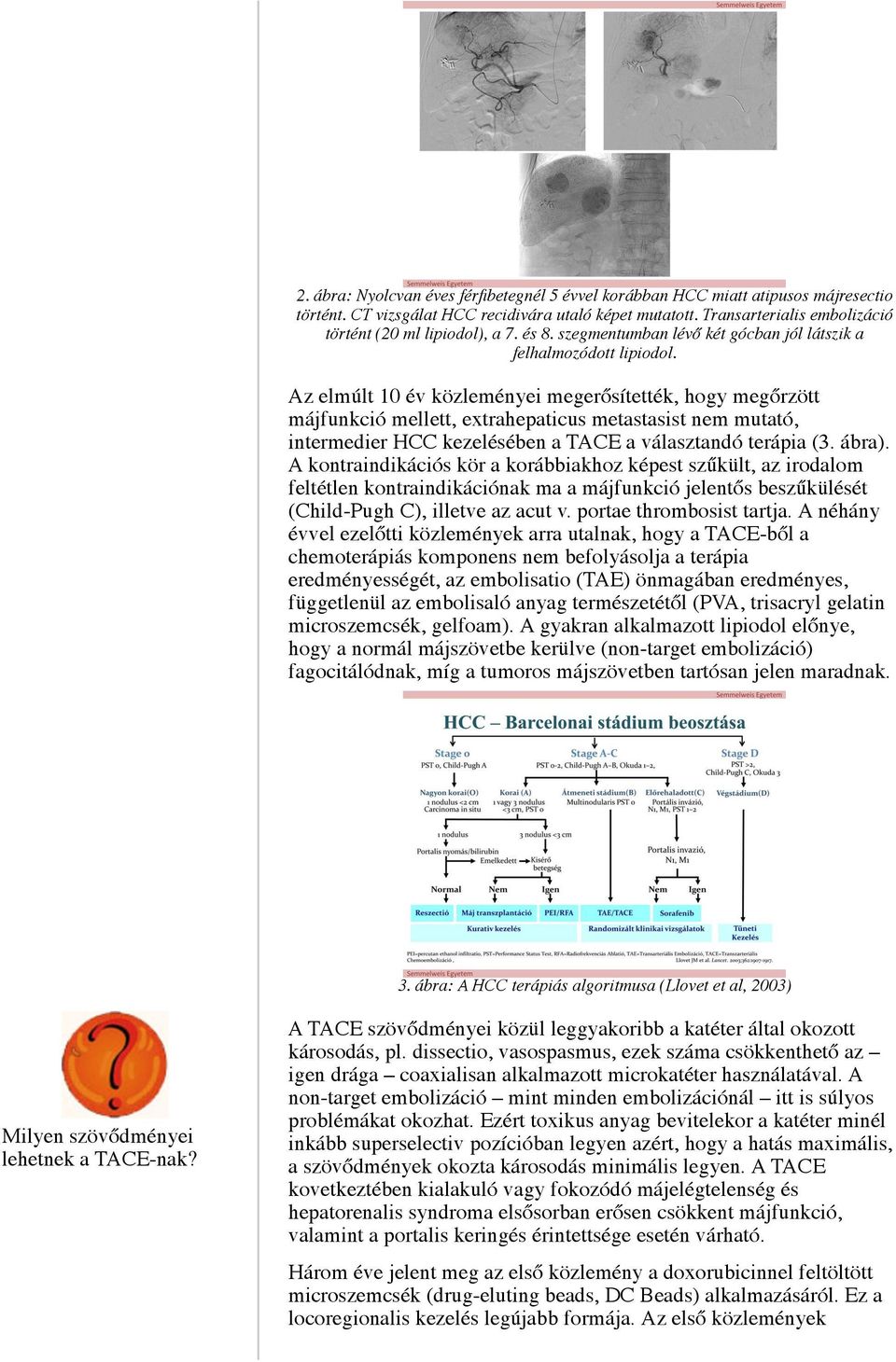 Az elmúlt 10 év közleményei megerősítették, hogy megőrzött májfunkció mellett, extrahepaticus metastasist nem mutató, intermedier HCC kezelésében a TACE a választandó terápia (3. ábra).