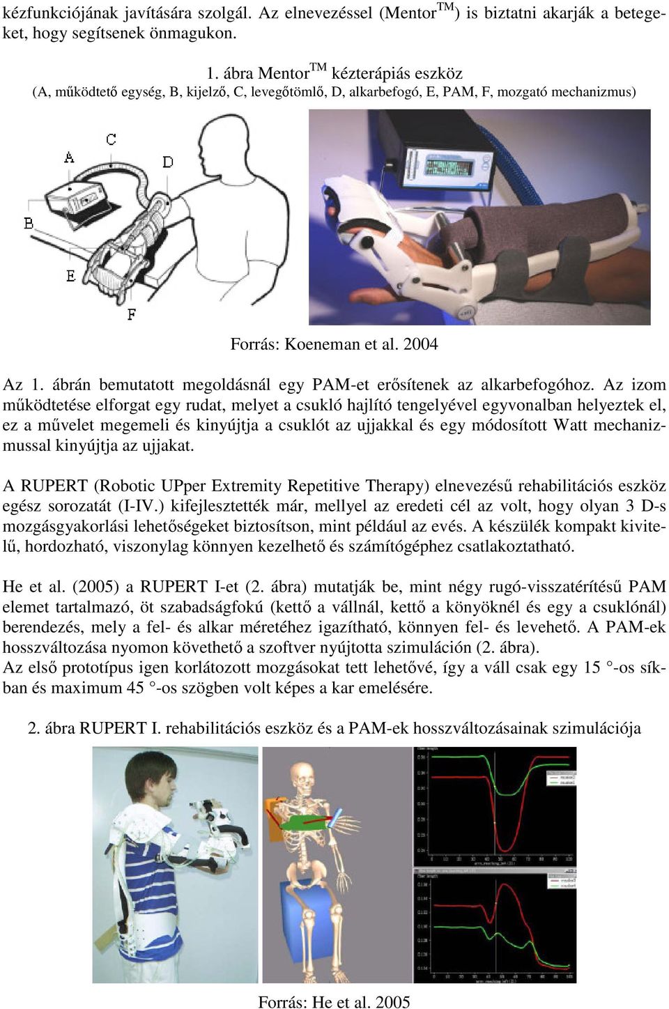 ábrán bemutatott megoldásnál egy PAM-et erősítenek az alkarbefogóhoz.