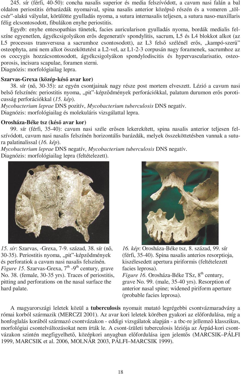 Egyéb: enyhe entesopathias tünetek, facies auricularison gyulladás nyoma, bordák medialis felszíne egyenetlen, ágyékcsigolyákon erős degeneratív spondylitis, sacrum, L5 és L4 blokkot alkot (az L5