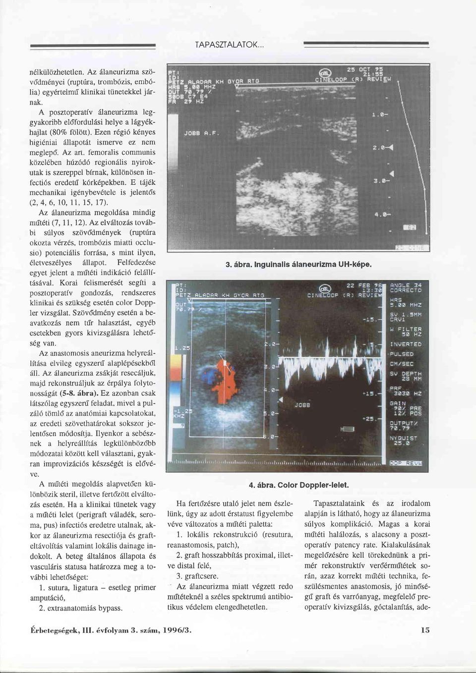 f"emoralis communis közel6ben hrizddd regionälis nyirokutak is szereppel birnak, különösen infectids eredetri körkdpekben.