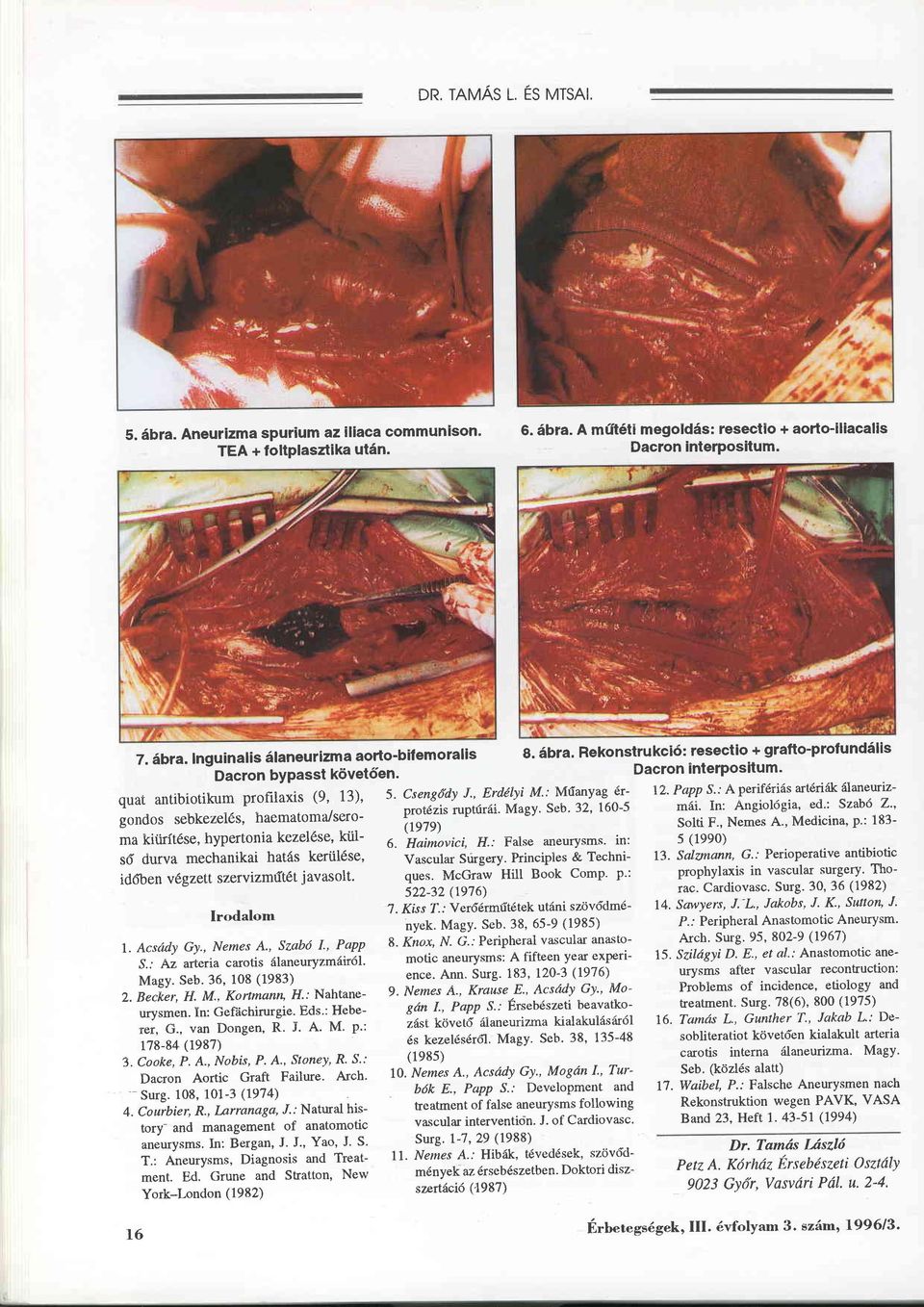 , Erdelyi M.; Müanyag 6r- gondos sebkezel6s, haematoma./seroma kitirftöse, hypertonia kezel6se, külsö' durva mechanikai hatäs kerül6se' iddben v gzett szervizmüt6t j avasolt' Irodalom l. Acsird.y Gy.