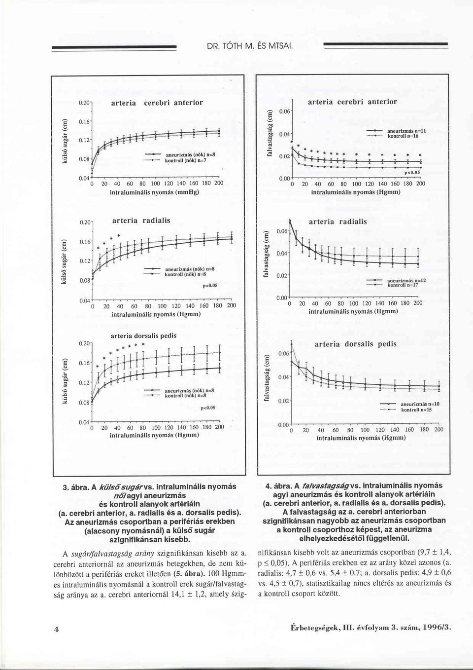 012 u ü 004 jl 0.08 0.02 zo 40 60 80 100 120 140 160 180 200 intraluminälis nyomäs (Hgmm) 000 0 20 40 60 80 100 120 140 160 180 200 intraluminälis nyomäs (Hgmm) L \cq u 0.20 0.