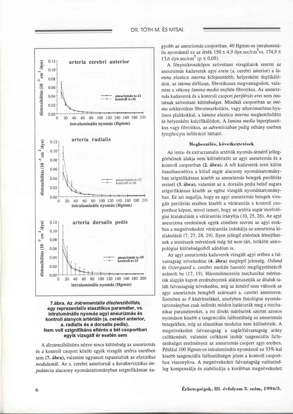 00 0 20 40 60 80 100 120 r40 160 180200 intraluminälis nyomäs (Hgrnm) 7.äbra. Az inlnem entälis disztenzibilitäs, egy reprezentativ elasztikus param6ter, vs.