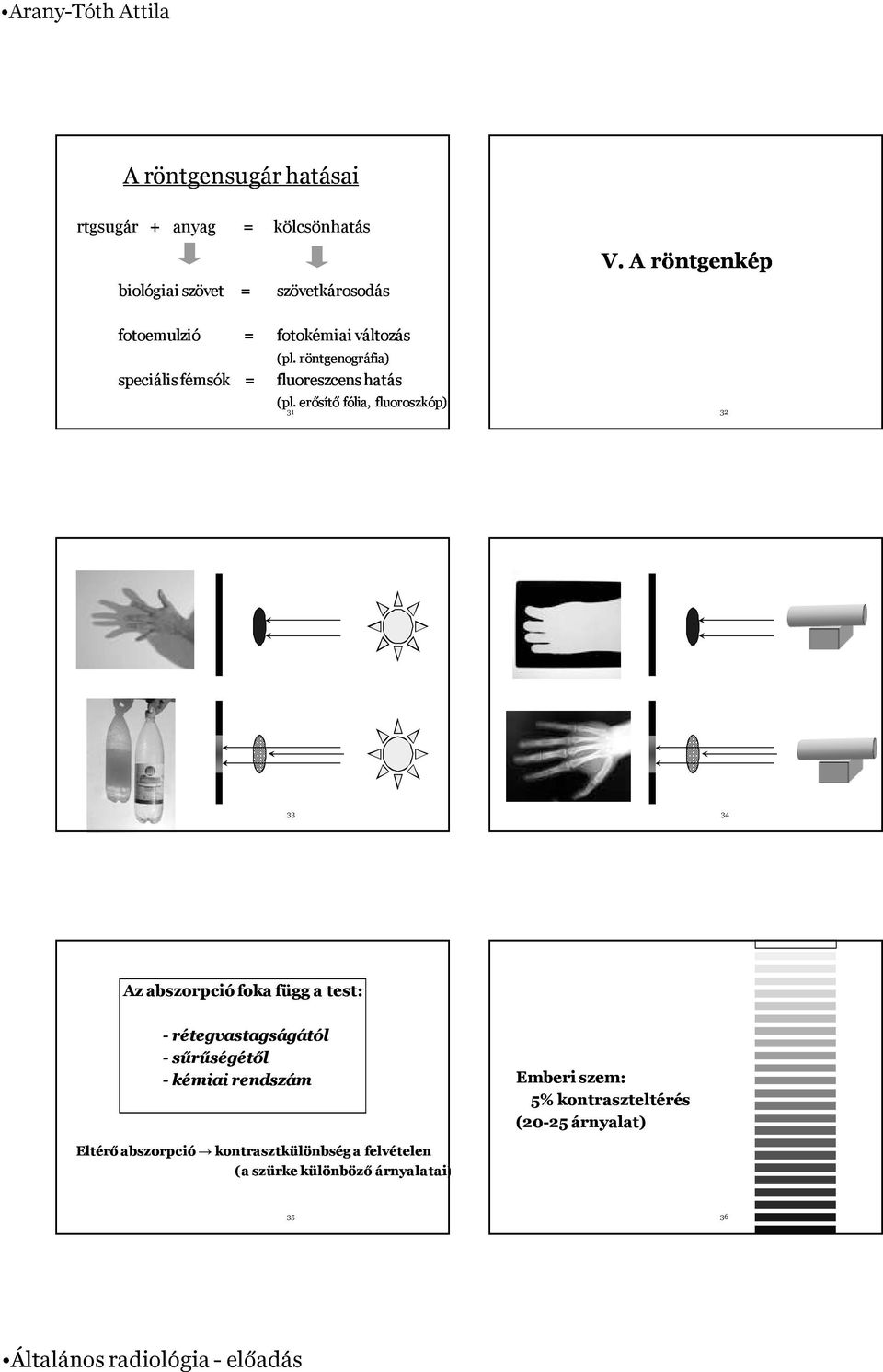 A röntgenkép 32 33 34 Az abszorpció foka függ a test: - rétegvastagságától - sűrűségétől - kémiai rendszám Emberi