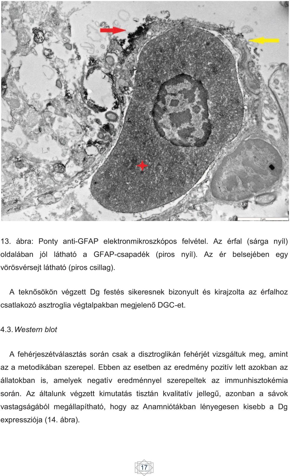 Western blot A fehérjeszétválasztás során csak a disztroglikán fehérjét vizsgáltuk meg, amint az a metodikában szerepel.