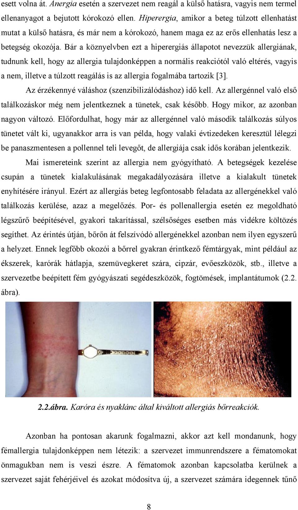 Bár a köznyelvben ezt a hiperergiás állapotot nevezzük allergiának, tudnunk kell, hogy az allergia tulajdonképpen a normális reakciótól való eltérés, vagyis a nem, illetve a túlzott reagálás is az