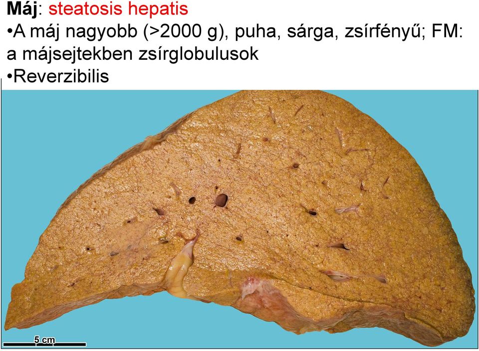sárga, zsírfényű; FM: a