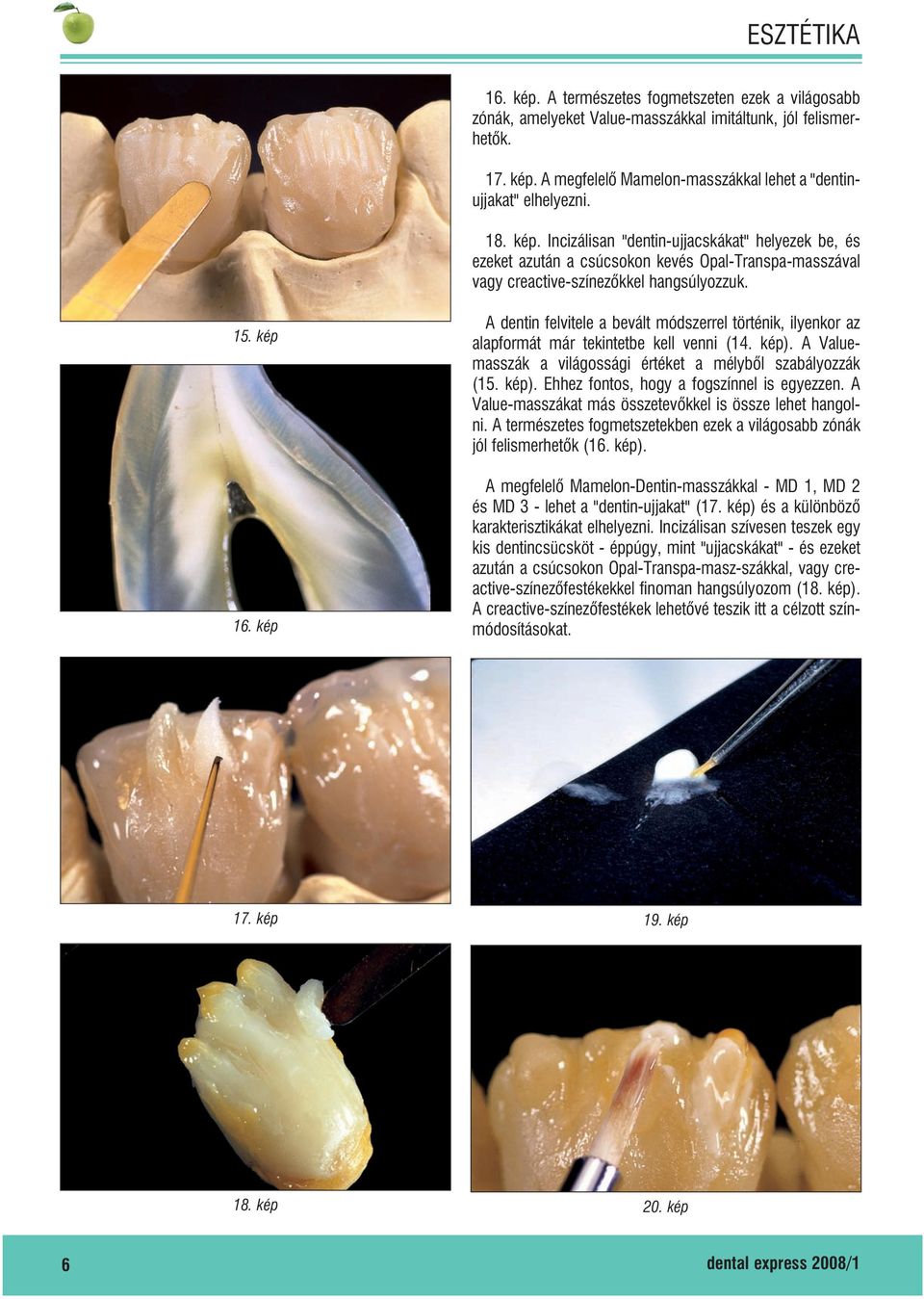 kép A dentin felvitele a bevált módszerrel történik, ilyenkor az alapformát már tekintetbe kell venni (14. kép). A Valuemasszák a világossági értéket a mélybõl szabályozzák (15. kép). Ehhez fontos, hogy a fogszínnel is egyezzen.