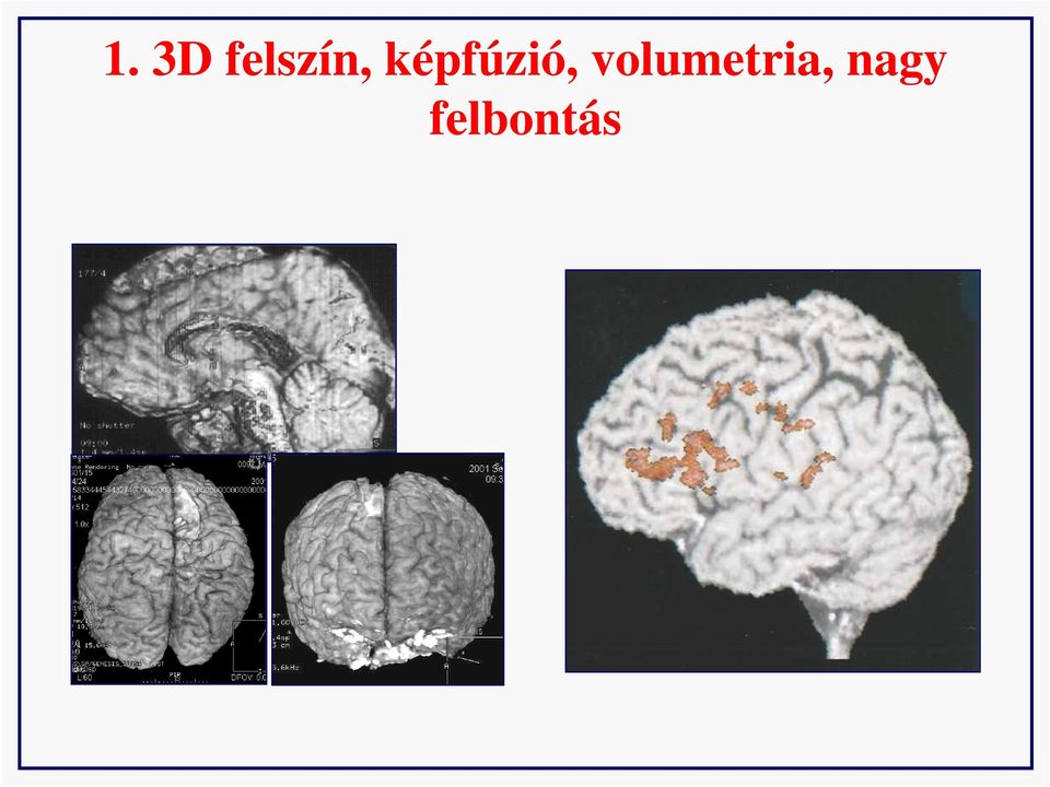 képfúzió,