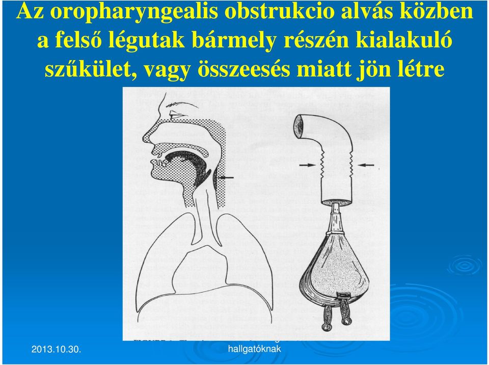 bármely részén kialakuló