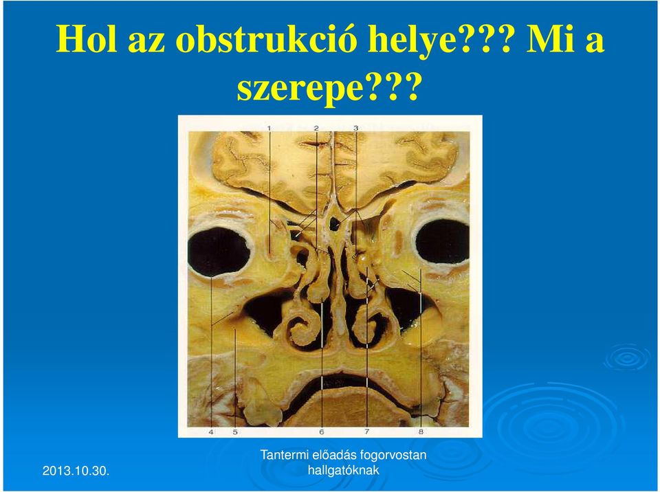 helye?
