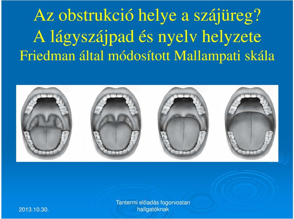 A lágyszájpad és nyelv
