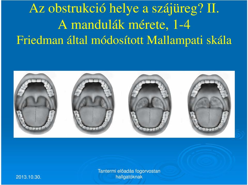 A mandulák mérete, 1-4
