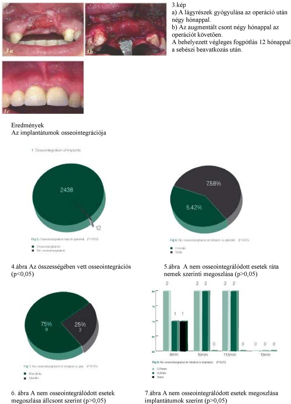 ábra Az összességében vett osseointegrációs (p<0,05) 5.ábra A nem osseointegrálódott esetek ráta nemek szerinti megoszlása (p>0,05) 6.