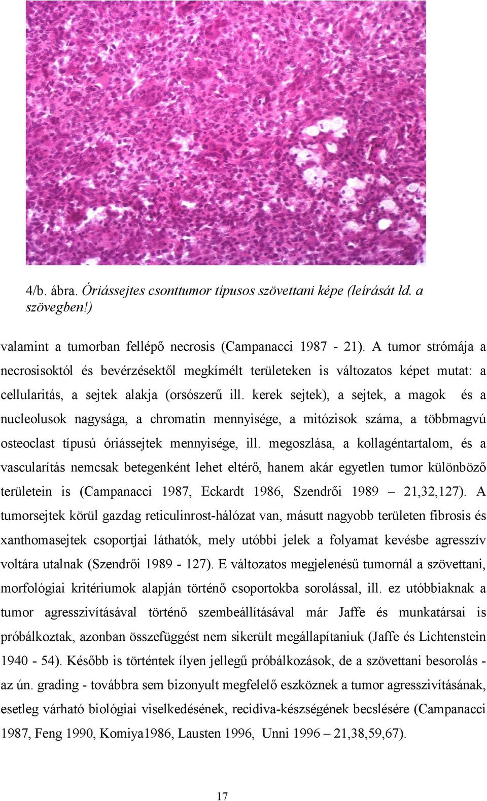 kerek sejtek), a sejtek, a magok és a nucleolusok nagysága, a chromatin mennyisége, a mitózisok száma, a többmagvú osteoclast típusú óriássejtek mennyisége, ill.