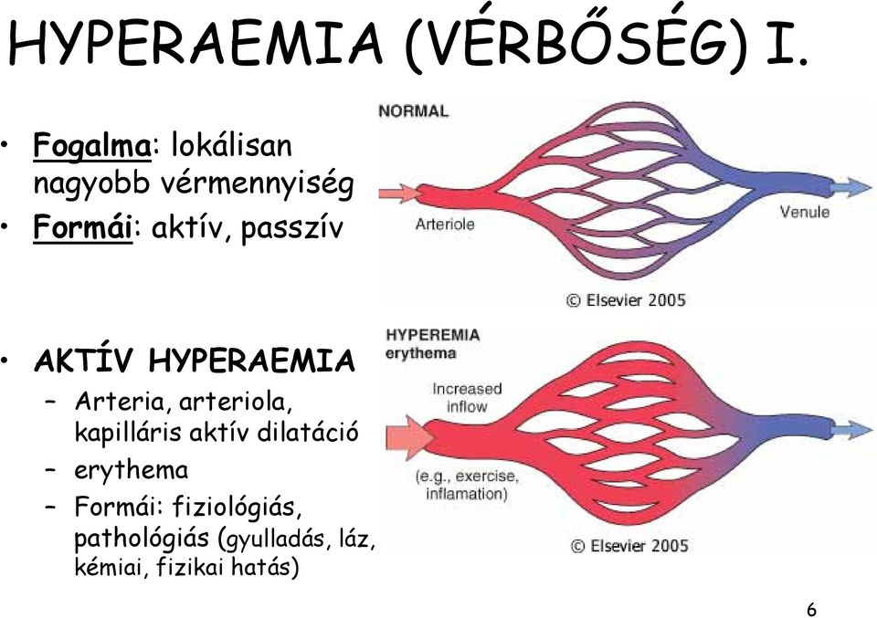 passzív AKTÍV HYPERAEMIA Arteria, arteriola, kapilláris