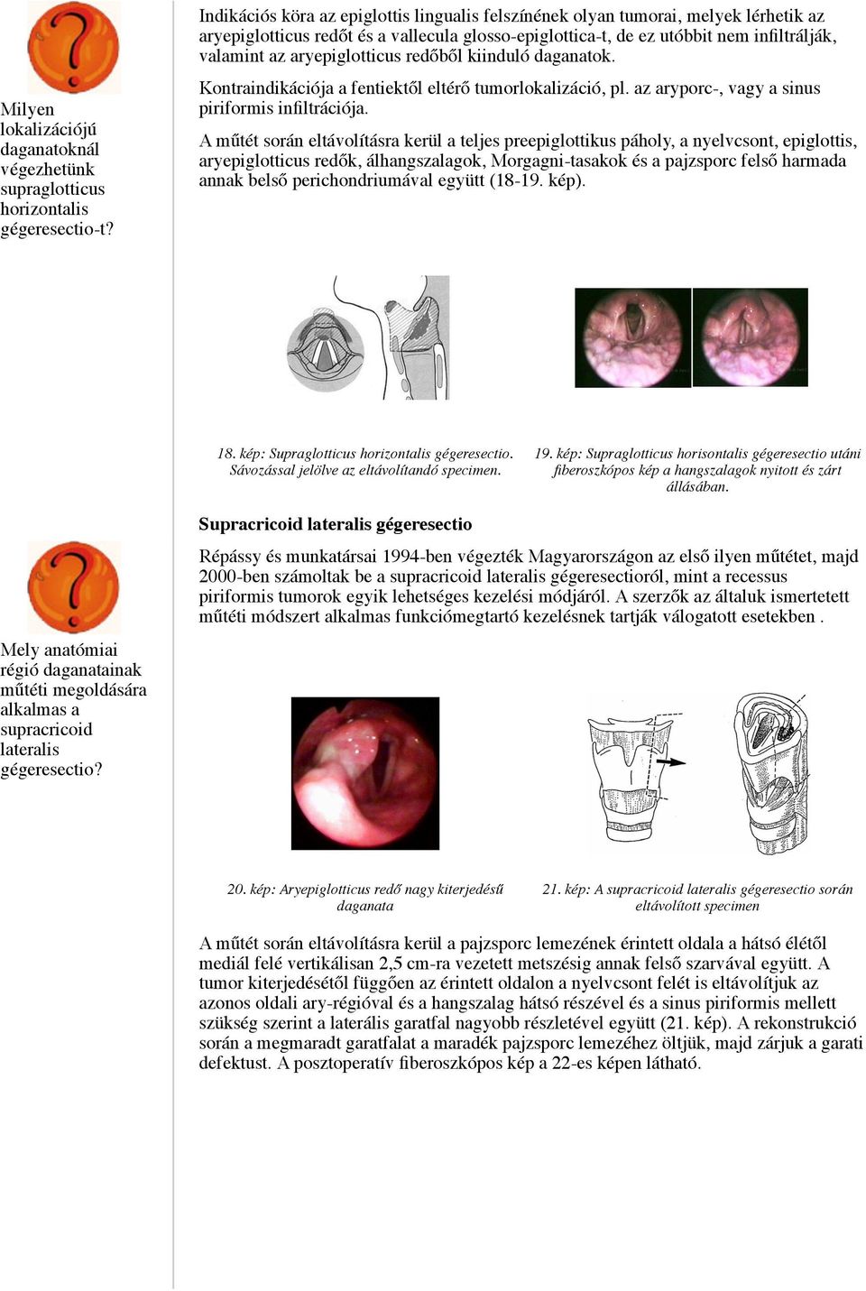 az aryporc-, vagy a sinus piriformis infiltrációja.