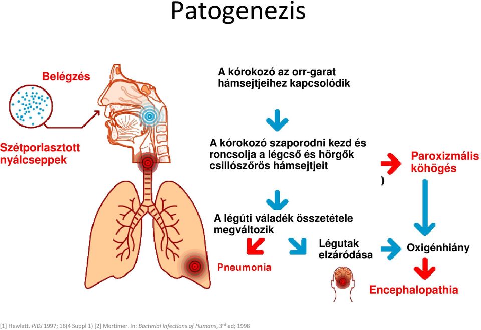 köhögés A légúti váladék összetétele megváltozik Légutak elzáródása Oxigénhiány Encephalopathia