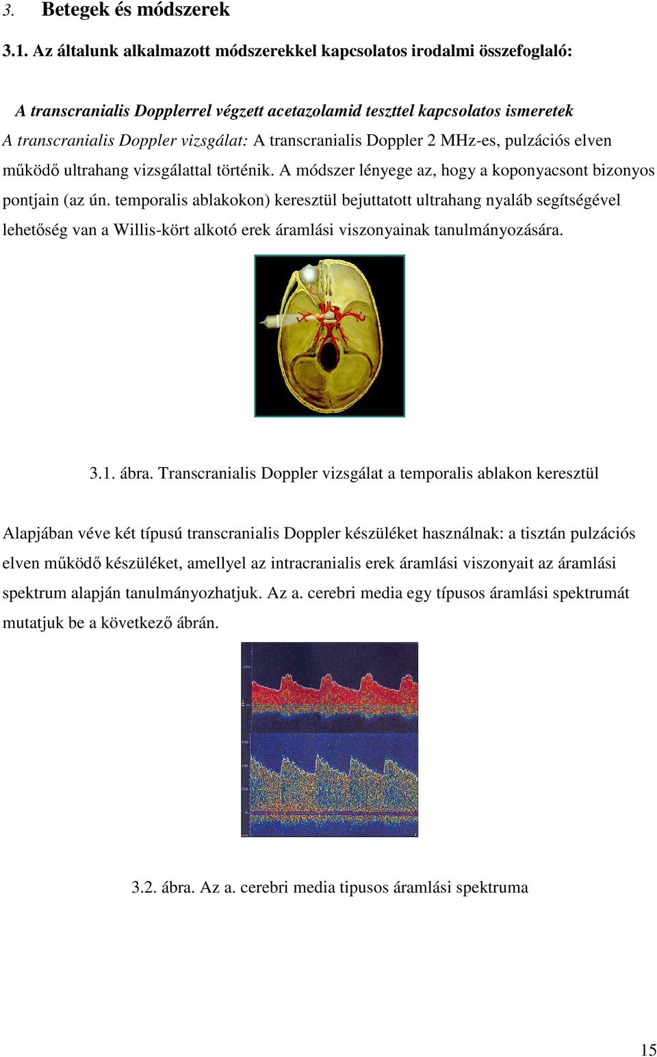 transcranialis Doppler 2 MHz-es, pulzációs elven működő ultrahang vizsgálattal történik. A módszer lényege az, hogy a koponyacsont bizonyos pontjain (az ún.