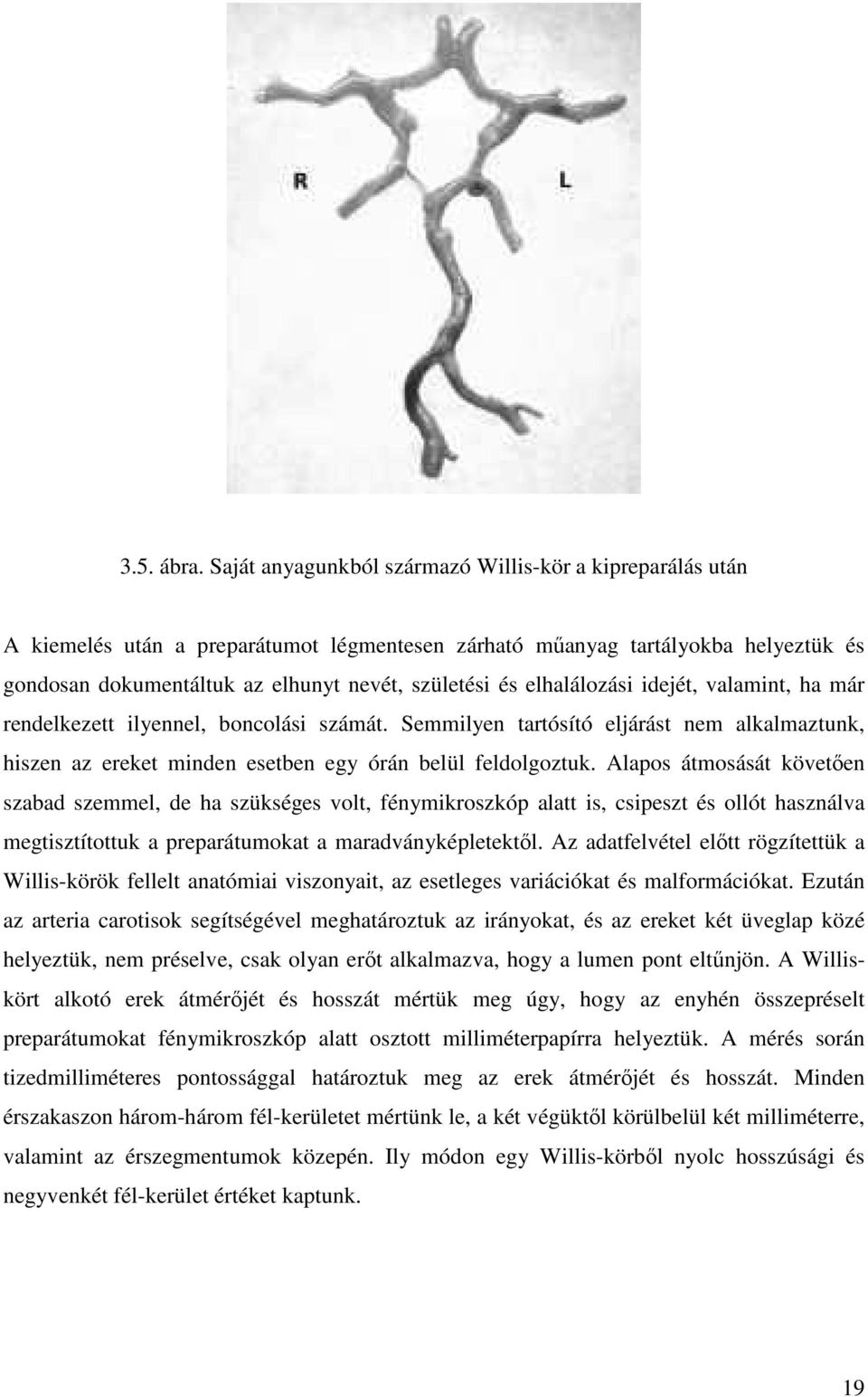 elhalálozási idejét, valamint, ha már rendelkezett ilyennel, boncolási számát. Semmilyen tartósító eljárást nem alkalmaztunk, hiszen az ereket minden esetben egy órán belül feldolgoztuk.