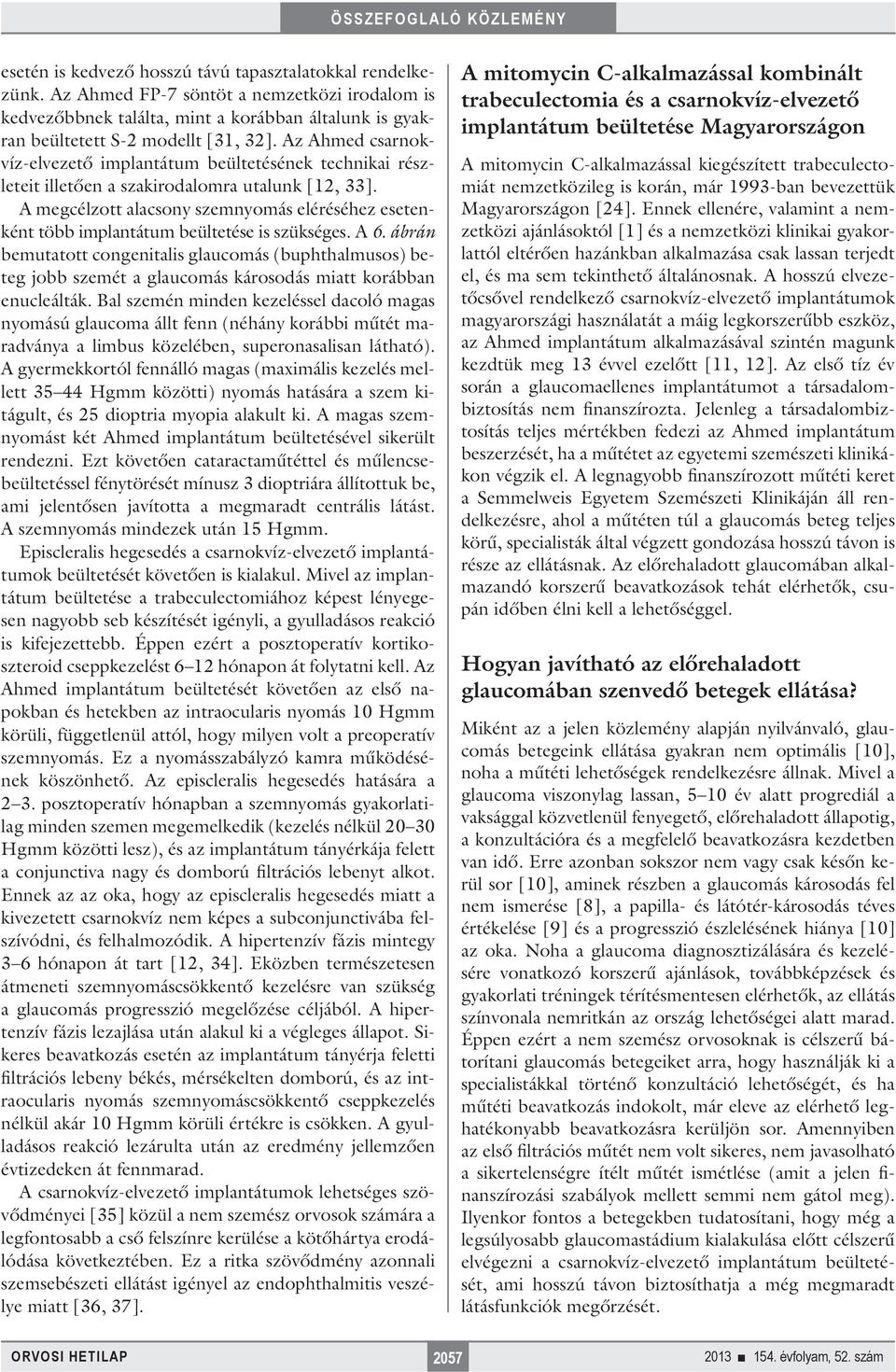 A megcélzott alacsony szemnyomás eléréséhez esetenként több implantátum beültetése is szükséges. A 6.