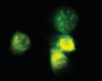 , Small 4 (2008) embermagzati csontképző sejtek
