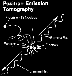 fotonokkal Protonok ~15 MeV, ~50 A Információ: metabolizmus Gamma -detektorok