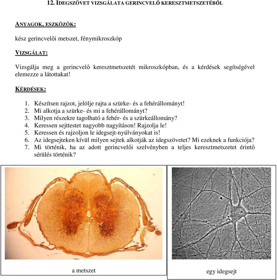 Milyen részekre tagolható a fehér- és a szürkeállomány? 4. Keressen sejttestet nagyobb nagyításon! Rajzolja le! 5. Keressen és rajzoljon le idegsejt-nyúlványokat is! 6.