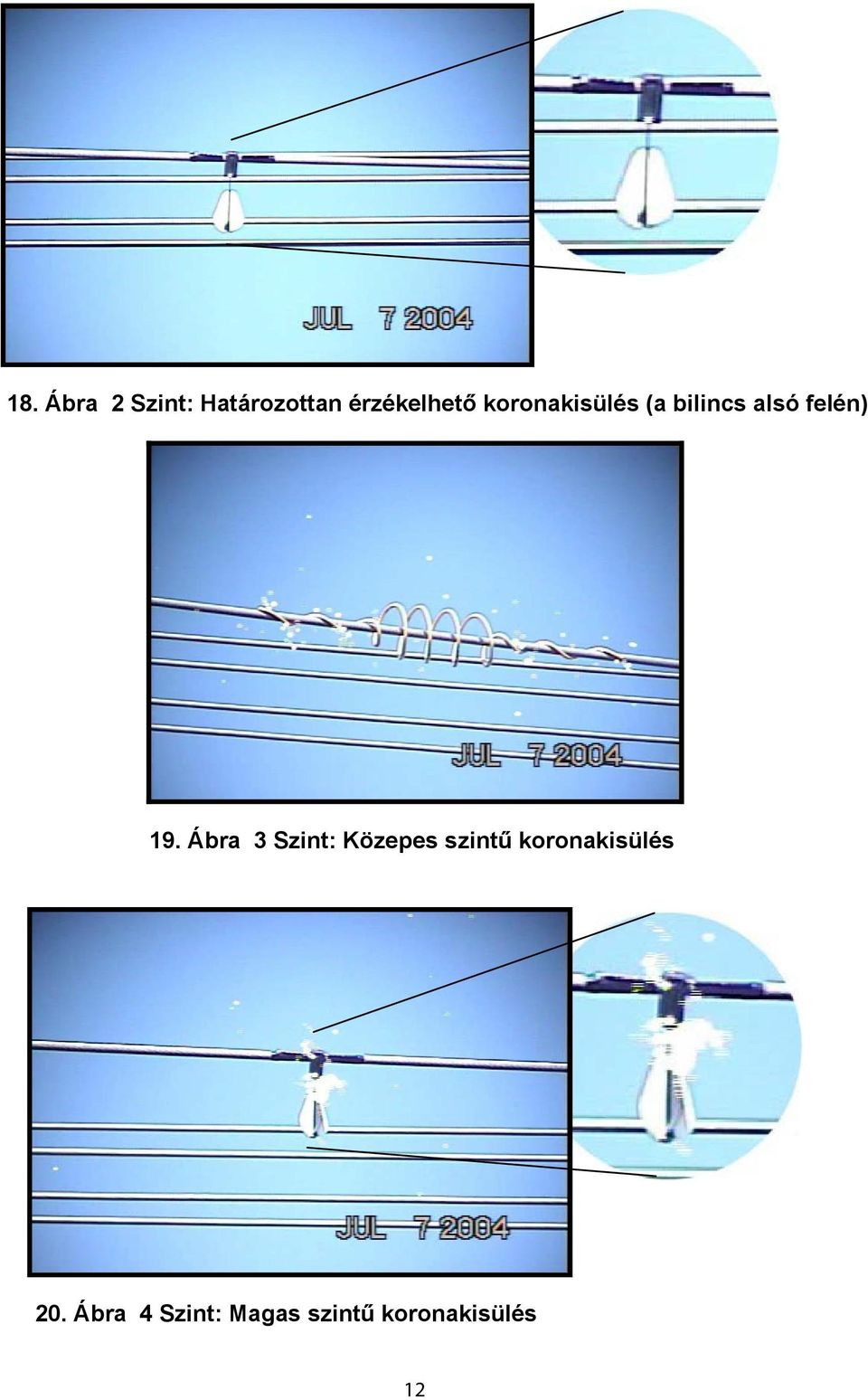 Ábra 3 Szint: Közepes szintű koronakisülés