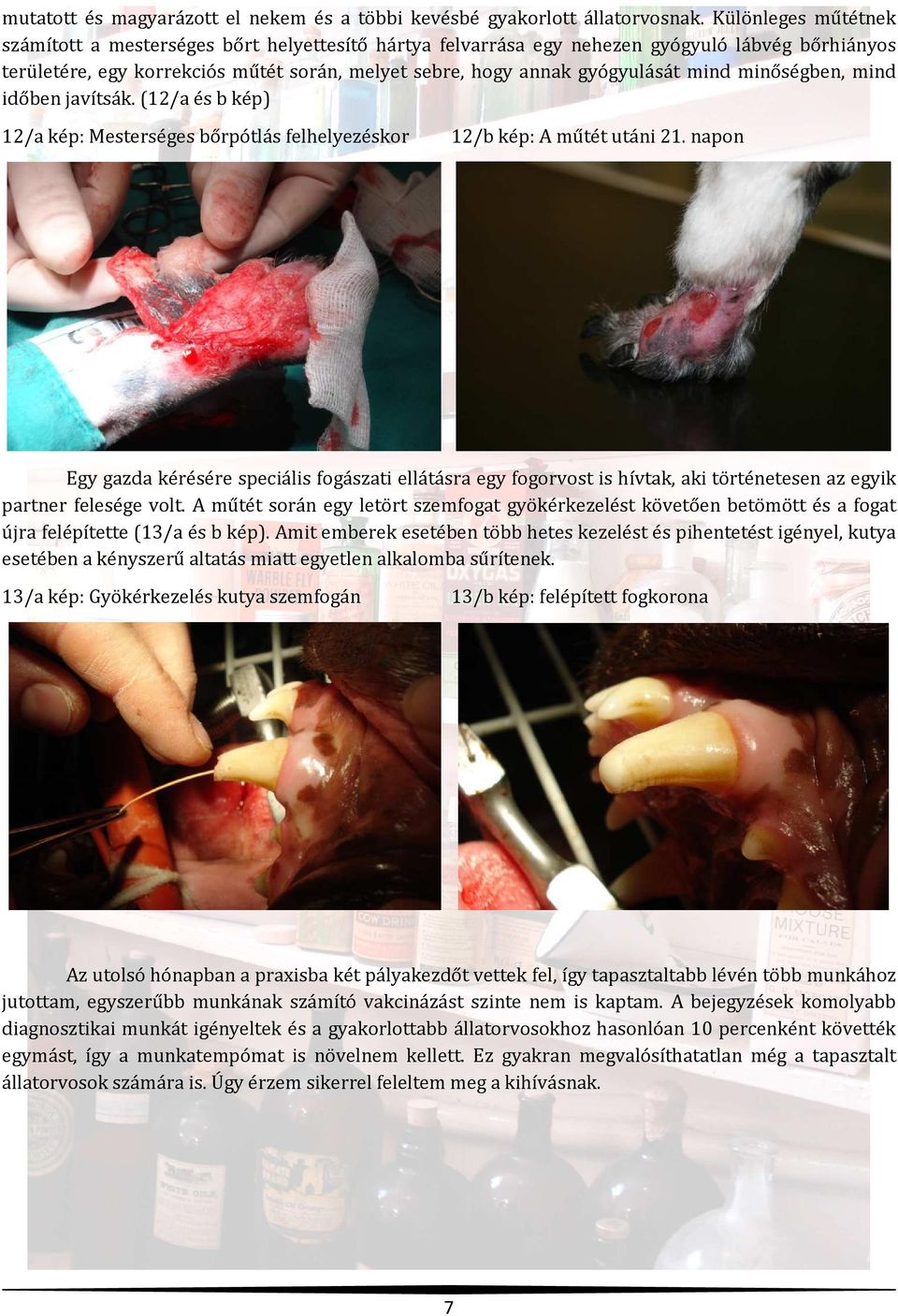 mind minőségben, mind időben javítsák. (12/a és b kép) 12/a kép: Mesterséges bőrpótlás felhelyezéskor 12/b kép: A műtét utáni 21.