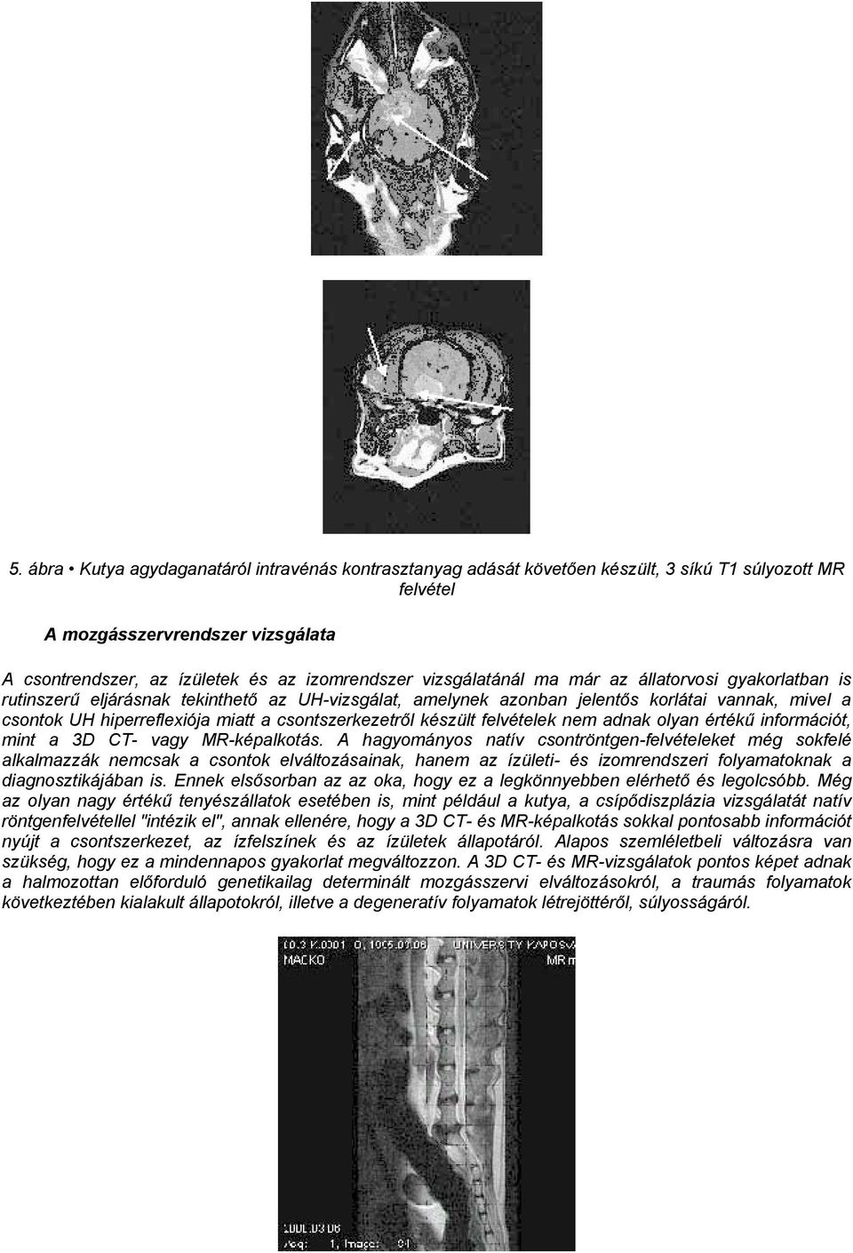 csontszerkezetről készült felvételek nem adnak olyan értékű információt, mint a 3D CT- vagy MR-képalkotás.
