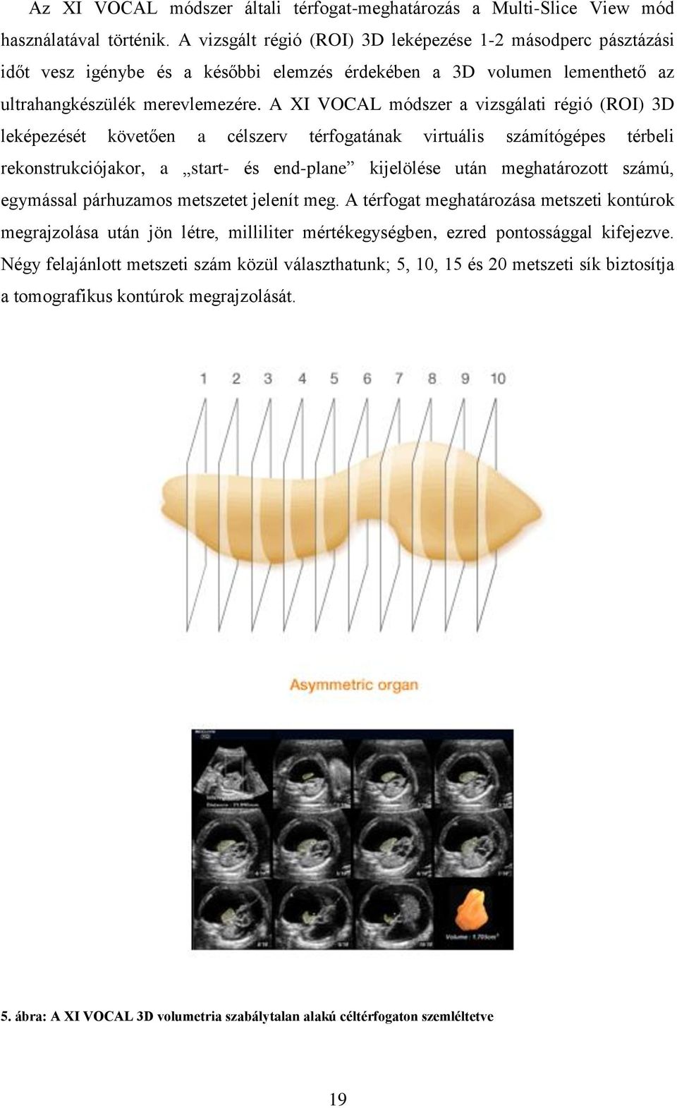 A XI VOCAL módszer a vizsgálati régió (ROI) 3D leképezését követően a célszerv térfogatának virtuális számítógépes térbeli rekonstrukciójakor, a start- és end-plane kijelölése után meghatározott