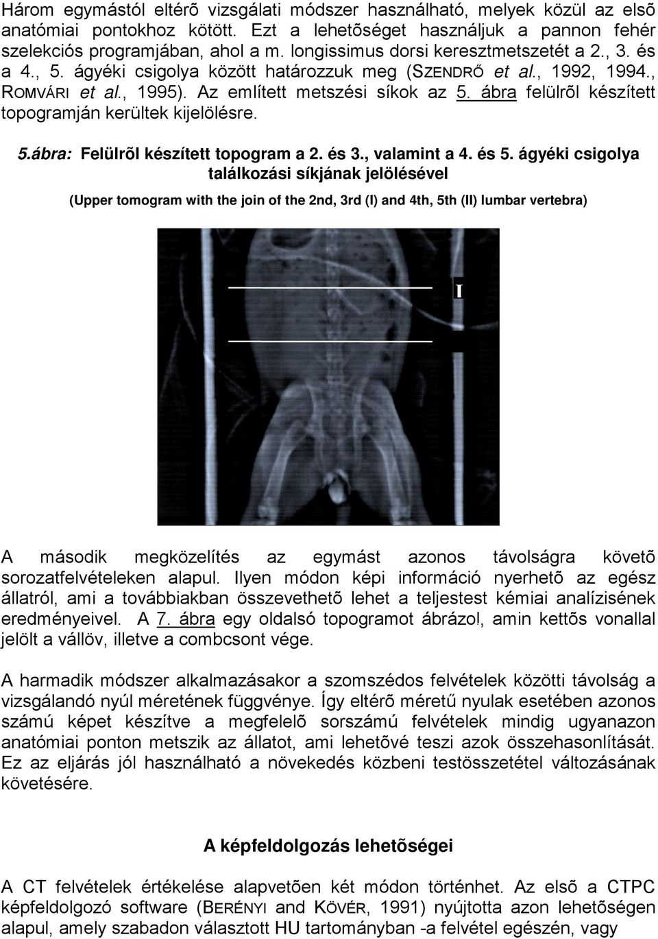 ábra felülrõl készített topogramján kerültek kijelölésre. 5.ábra: Felülrõl készített topogram a 2. és 3., valamint a 4. és 5.