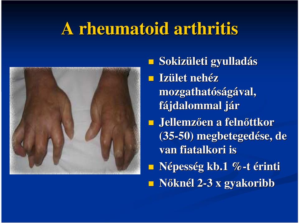 a felnıttkor (35-50) 50) megbetegedése, de van