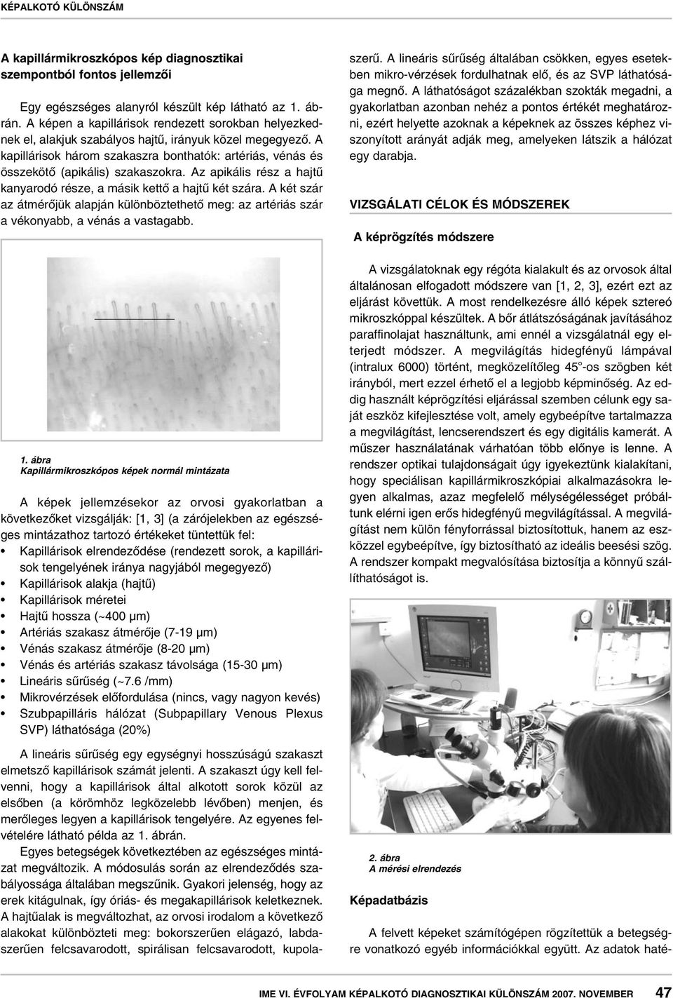 A kapillárisok három szakaszra bonthatók: artériás, vénás és összekötô (apikális) szakaszokra. Az apikális rész a hajtû kanyarodó része, a másik kettô a hajtû két szára.