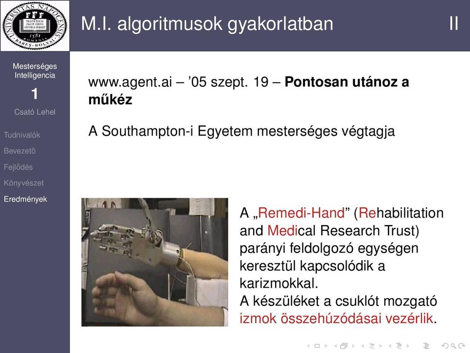 Remedi-Hand (Rehabilitation and Medical Research Trust) parányi feldolgozó