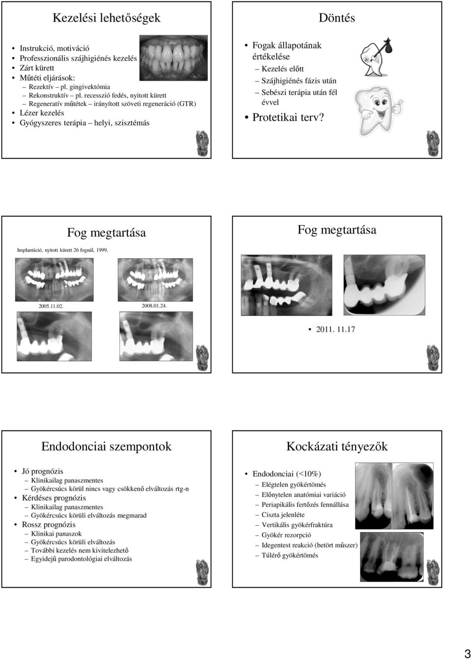 Szájhigiénés fázis után Sebészi terápia után fél évvel Protetikai terv? Fog megtartása Fog megtartása Implantáció, nyitott kürett 26 fognál, 1999. 2005.11.02. 2008.01.24. 2011. 11.