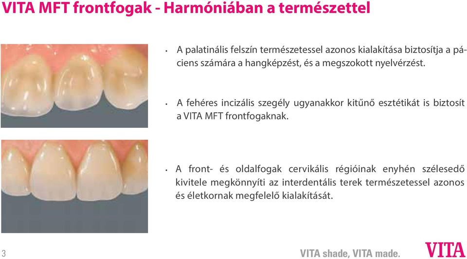 A fehéres incizális szegély ugyanakkor kitűnő esztétikát is biztosít a VITA MFT frontfogaknak.