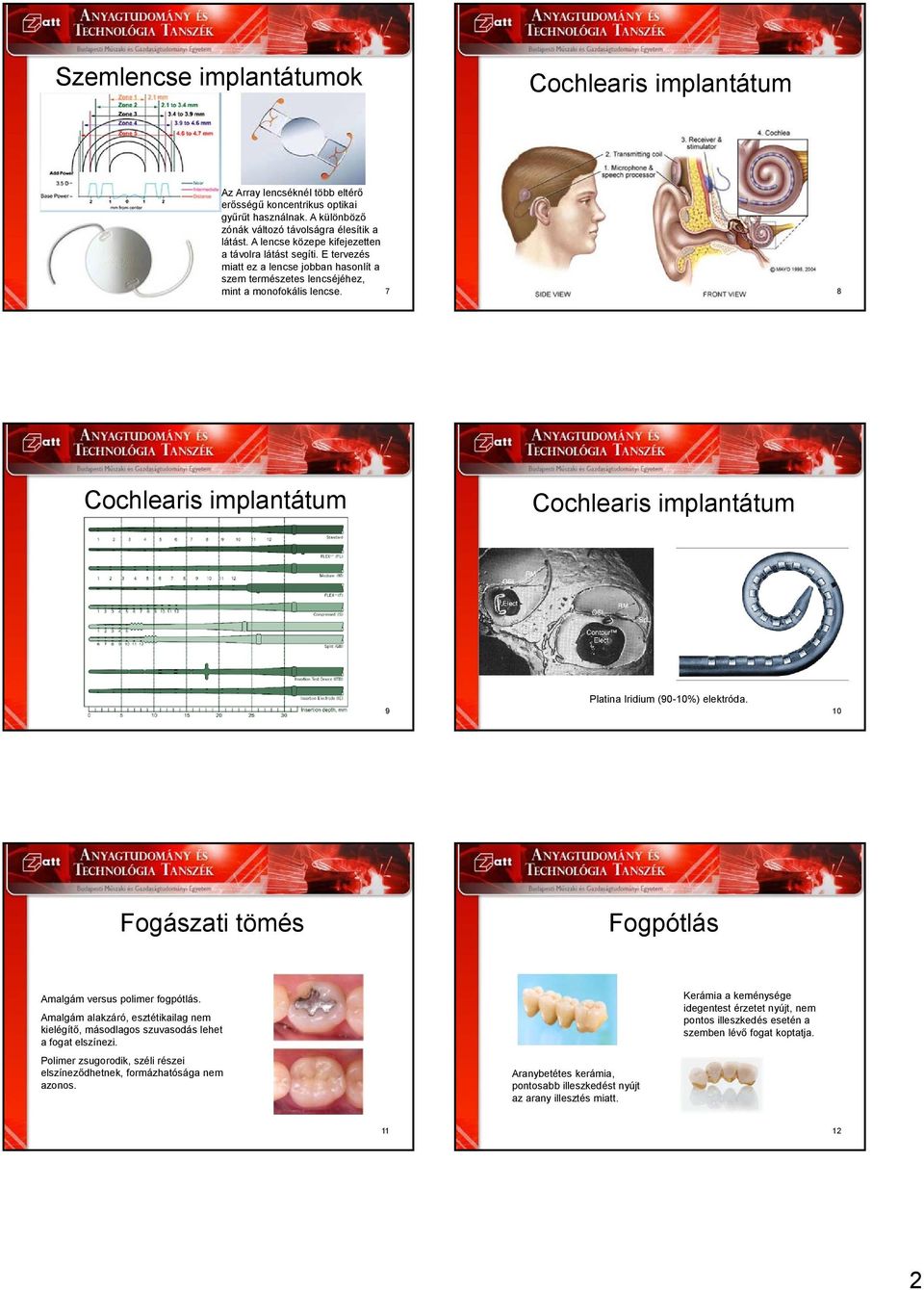 7 8 Cochlearis implantátum Cochlearis implantátum 9 Platina Iridium (90-10%) elektróda. 10 Fogászati tömés Fogpótlás Amalgám versus polimer fogpótlás.