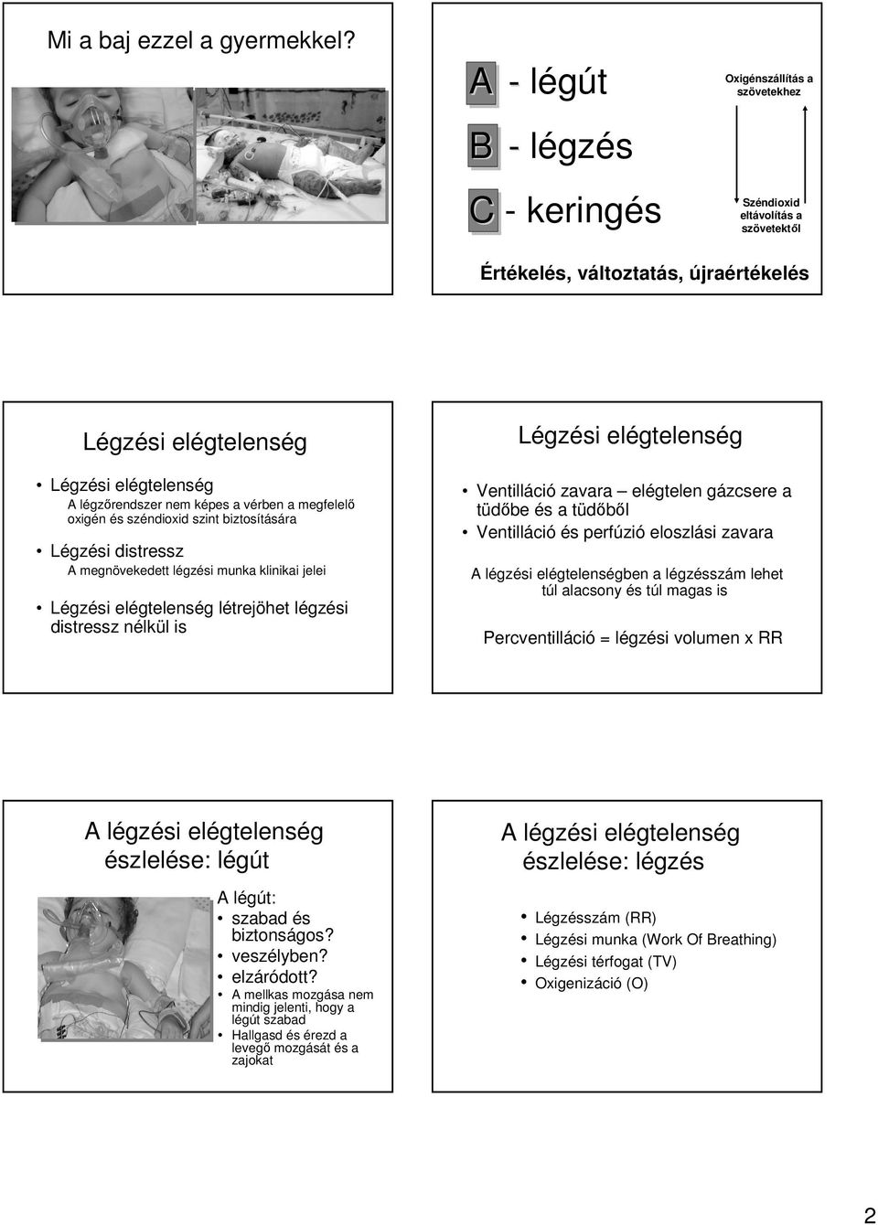 megfelelı oxigén és széndioxid szint biztosítására Légzési distressz A megnövekedett légzési munka klinikai jelei Légzési létrejöhet légzési distressz nélkül is Légzési Ventilláció zavara elégtelen