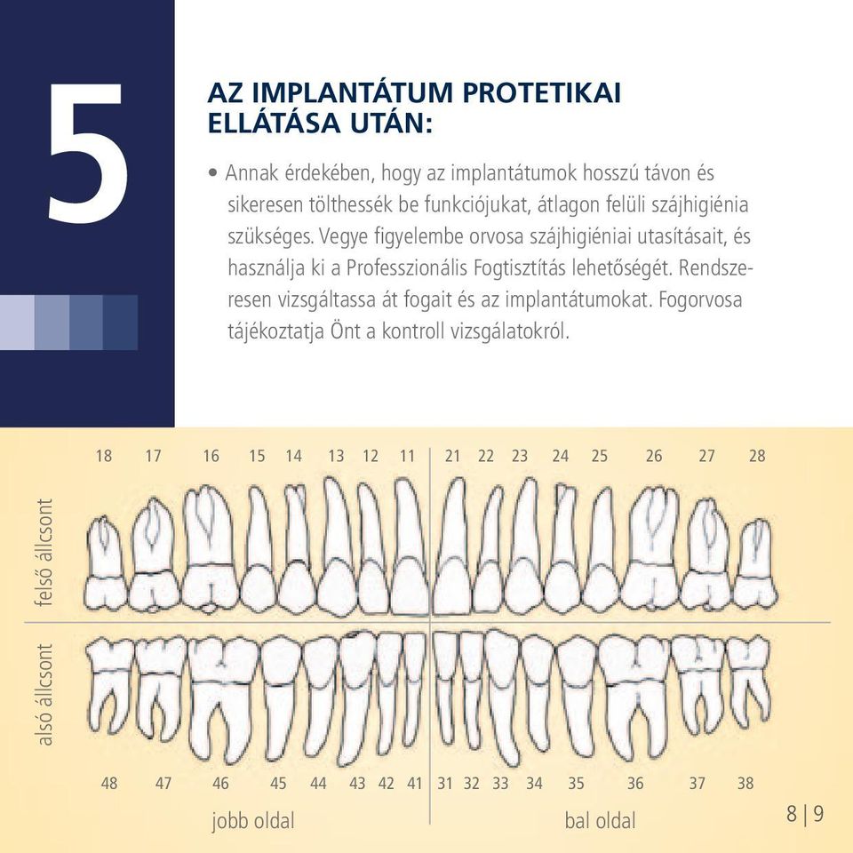 Fogorvosa Wie natürliche Zähne benötigen auch Implantatversorgungen gründliche Pflege.