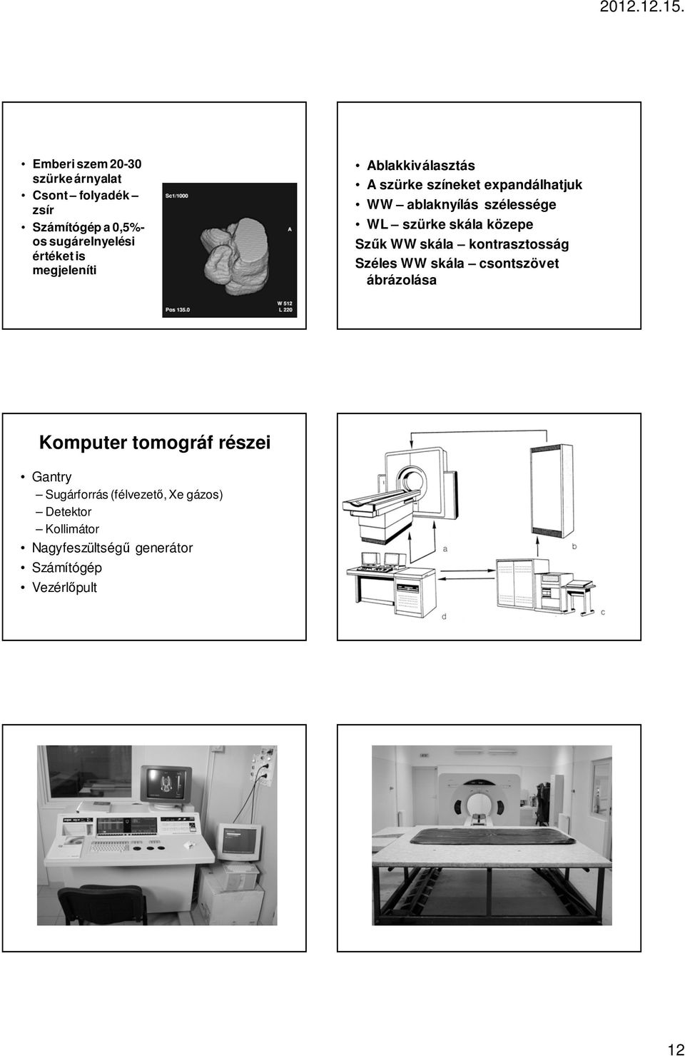 közepe Szők WW skála kontrasztosság Széles WW skála csontszövet ábrázolása Komputer tomográf részei